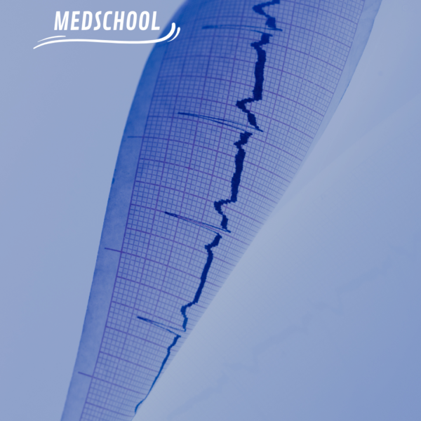 Taller de lectura e interpretación de electrocardiograma