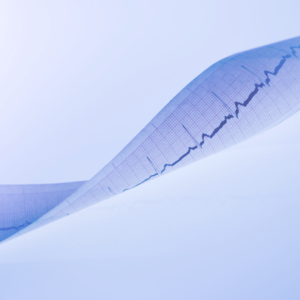 Lectura e interpretación de Electrocardiograma