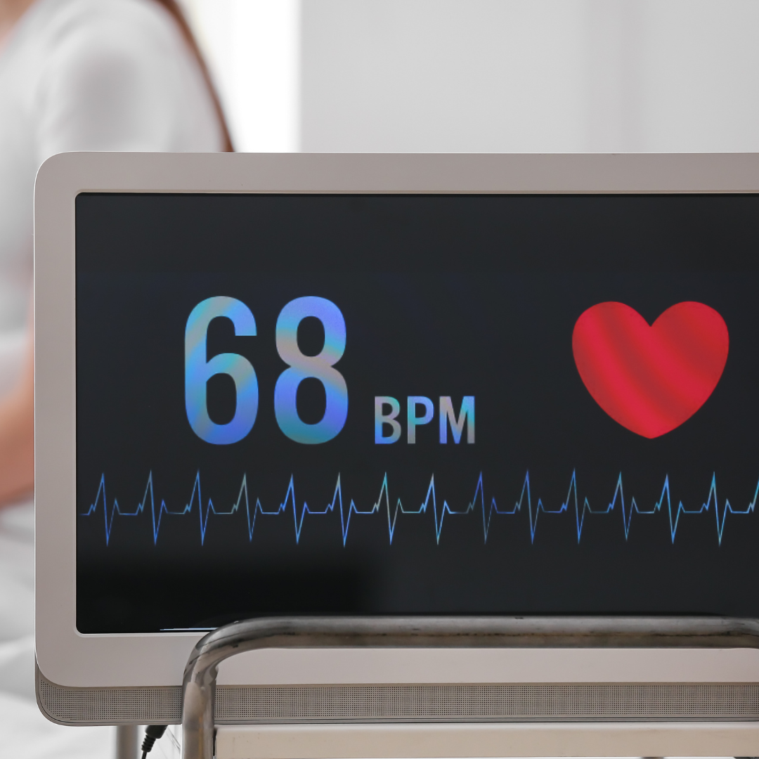 Cómo Calcular la Frecuencia Cardíaca en un Electrocardiograma: Guía para Estudiantes de Medicina